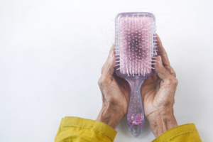 Hair Lose
