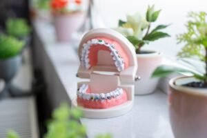 Orthodontic