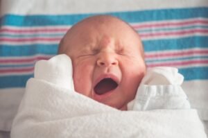 Newborn Chapped Lips