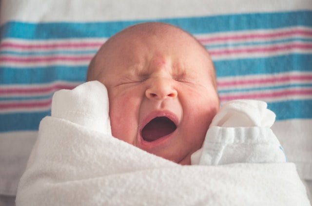 Newborn Chapped Lips
